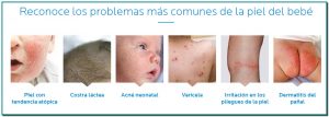 Cómo cuidar la piel de mi bebé LA ROCHE-POSAY Solución segura clínicamente probada La Roche-Posay